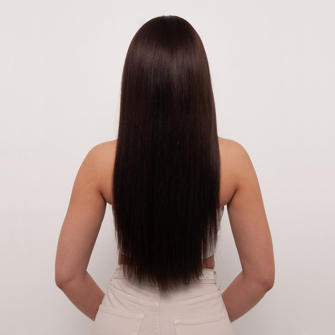 Kylie First Class - Alopeci